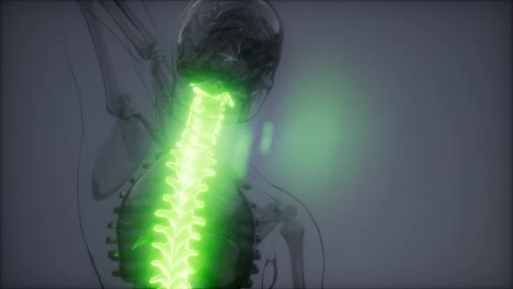 Backache-in-Back-Bones